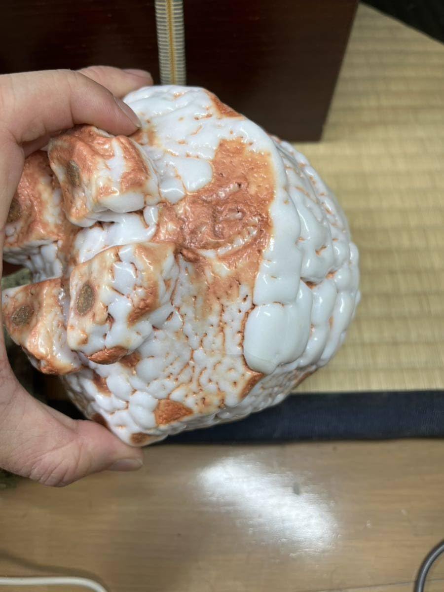 人間国宝　林正太郎　志野掻き取り紋 人間国宝 林正太郎 志野掻き取り紋 - メルカリ